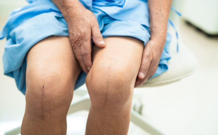 Types of Knee Replacement Surgeries Offered in Malad: Partial vs. Total Knee Replacement
