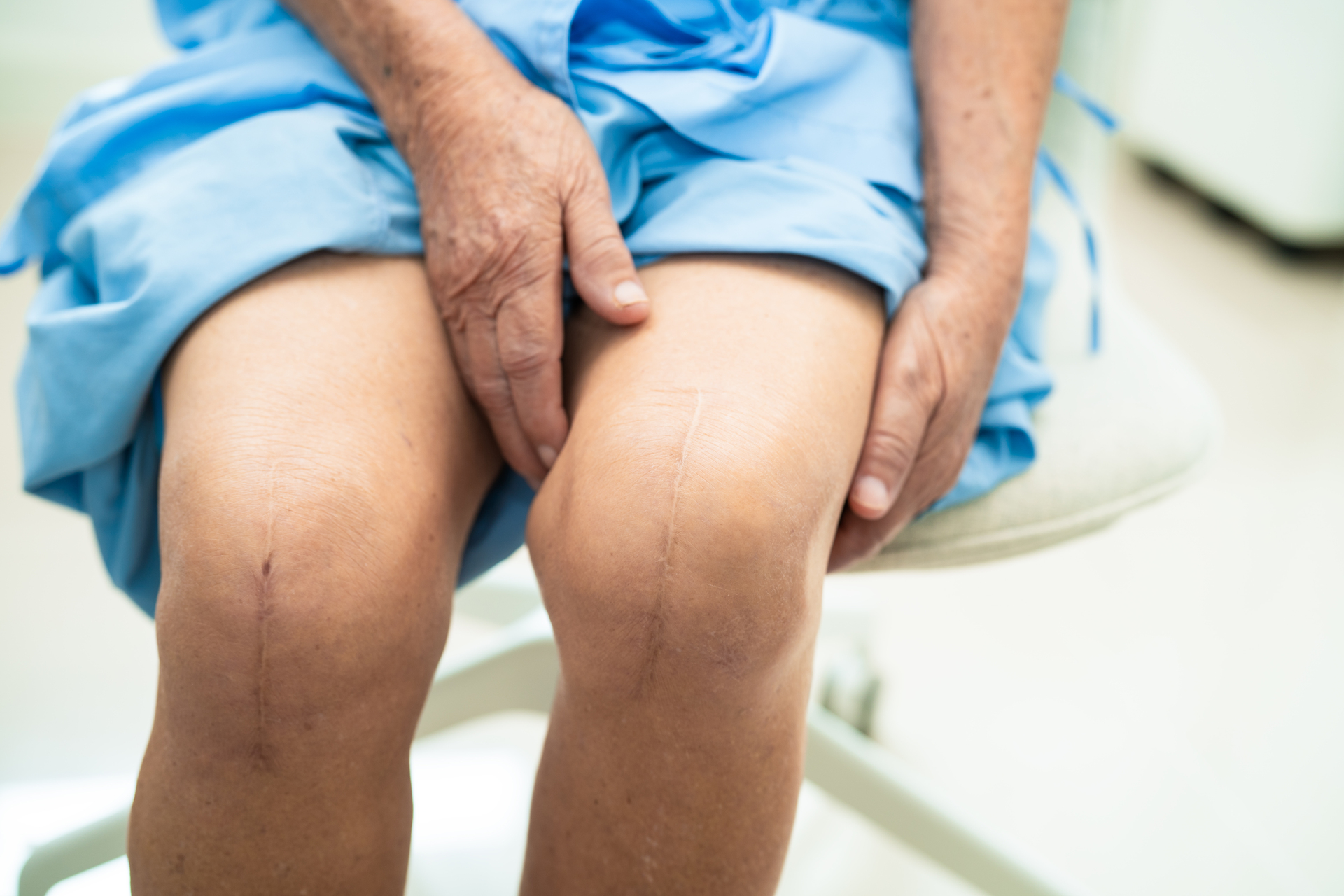 Partial Knee Replacement or a Total Knee Replacement