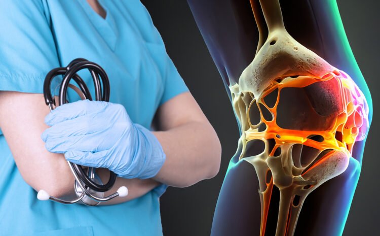  Top 5 Signs You May Need a Knee Replacement 