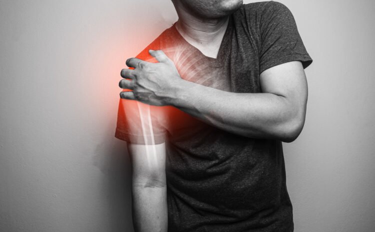  The Top 5 Causes of Shoulder Pain in Malad and When to See a Doctor 