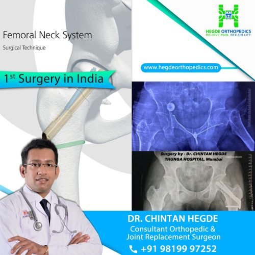 DrChintan R Hegde Session On Advances In Knee Replacement Surgery3